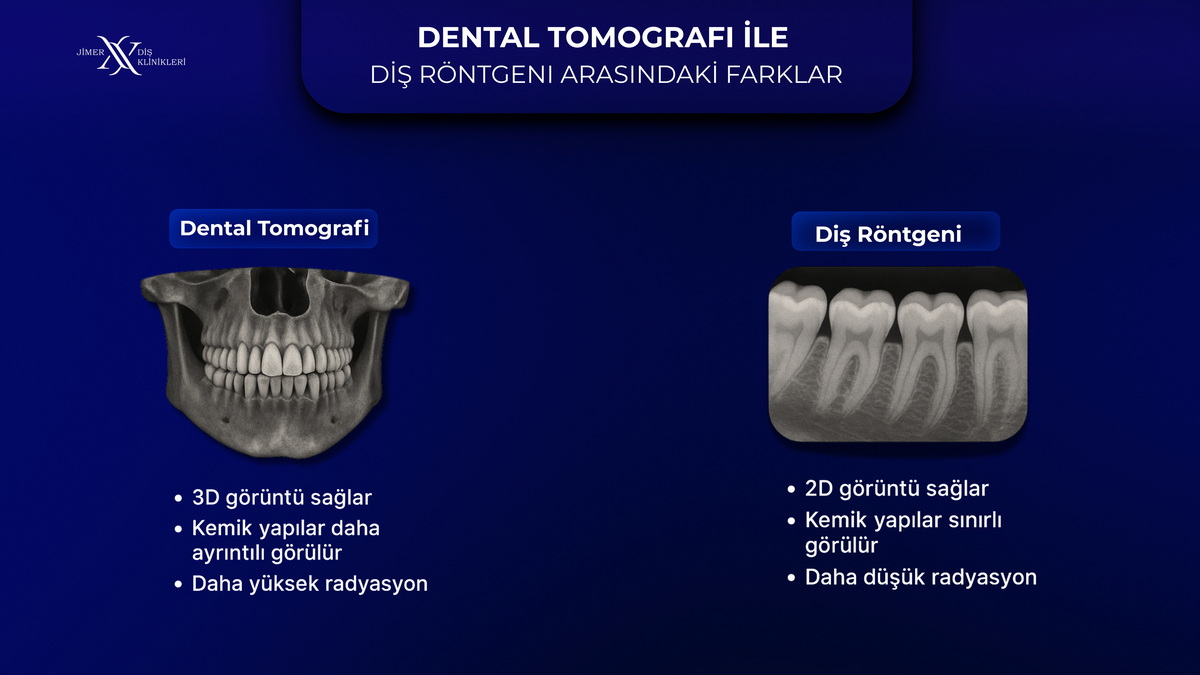  Volümetrik Dental Tomografi ve Panoramik Röntgen Nedir?