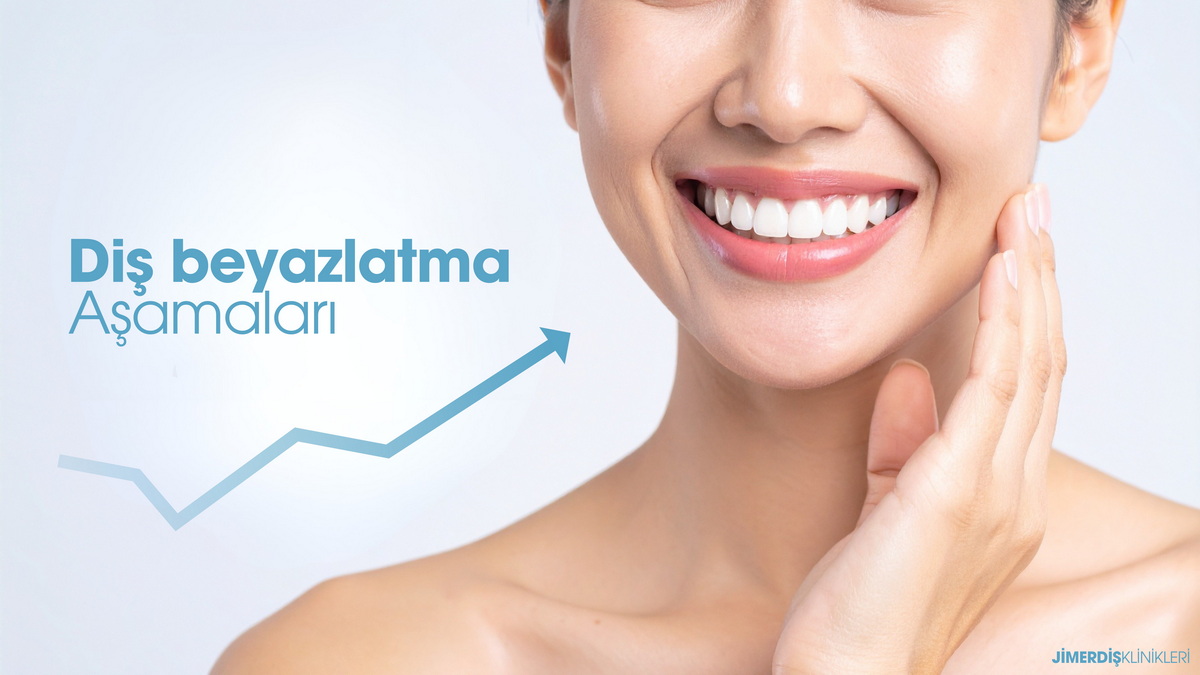Jimer Diş Klinikleri Diş Beyazlatma Aşamaları